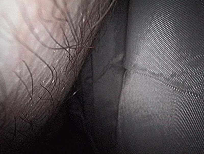 body1