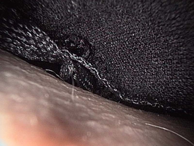 body13