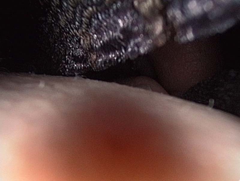 body14