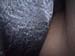 body11